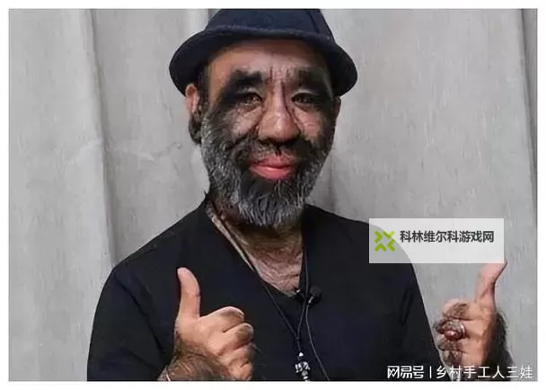 多毛性老奶奶的夏日微光图1