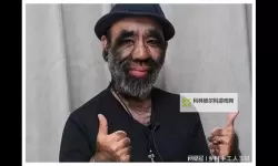 多毛性老奶奶的夏日微光